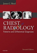 Chest Radiology