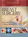 Breast Surgery (Master Techniques in General Surgery)