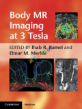 Body MR Imaging at 3 Tesla (Color)
