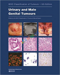 WHO Urinary and Male Genital Tumours (Color)