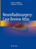 NeuroRadiosurgery: Case Review Atlas  (Color)