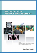 An Update on Airway Management (Color)