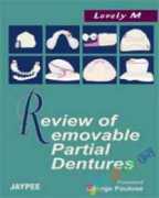 Review of Removable Partial Dentures