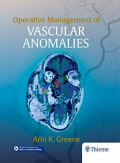 Operative Management of Vascular Anomalies (Color)