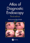 Atlas of diagnostic endoscopy (Color)
