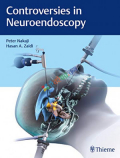 Controversies in Neuroendoscopy (Color)
