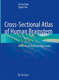 Cross-Sectional Atlas of Human Brainstem (Color)