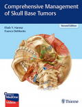 Comprehensive Management of Skull Base Tumors (Color)