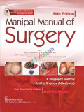Manipal Manual of Surgery