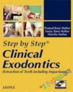 Step by Step Clinical Exodontics (with DVD-ROM)