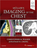Muller's Imaging of the Chest (Color)