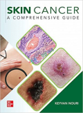 Skin Cancer A Comprehensive Guide 2023