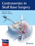 Controversies in Skull Base Surgery