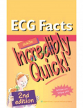 ECG Facts Made Incredibly Quick (Color)