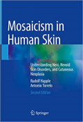 Mosaicism in Human Skin (Color)