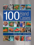 100 Hand Cases (Color)