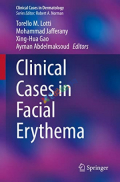 Clinical Cases in Facial Erythema (Color)