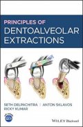 Principles of Dentoalveolar Extractions( Color)
