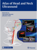 Atlas of Head and Neck Ultrasound(color)