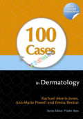 100 Cases in Dermatology (Color)