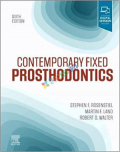 Contemporary Fixed Prosthodontics (Color)