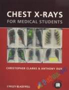 Chest X Rays For Medical Students (Color)