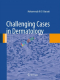 Challenging Cases in Dermatology (B&W)