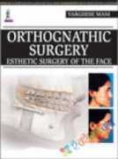 Orthognathic Surgery : Esthetic Surgery of the Face