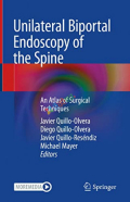 Unilateral Biportal Endoscopy of the Spine (Color)