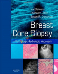 Breast Core Biopsy (Color)
