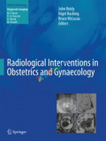 Radiological Interventions in Obstetrics and Gynaecology (Color)