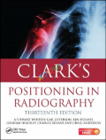 Clark's Positioning in Radiography (Color)