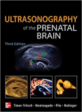 Ultrasonography of the Prenatal Brain (Color)