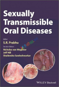 Sexually Transmissible Oral Diseases (Color)