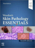 Weedon's Skin Pathology Essentials (Color)