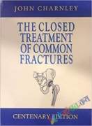 The Closed Treatment of Common Fractures