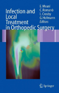 Infection And Local Treatment In Orthopedic Surgery (Color)