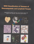 Who Classification of Tumours of Hematopoietic and Lymphoid Tissues