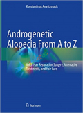 Androgenetic Alopecia From A to Z (Color)