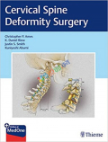 Cervical Spine Deformity Surgery (Color)
