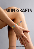 Skin Grafts (Color)
