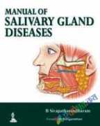 Manual of Salivary Gland Diseases