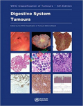 WHO Digestive System Tumours (Color)