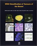 WHO Tumours of The Breast (Color)