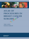 Atlas of Procedures in Breast Cancer Surgery (Color)