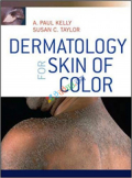Dermatology for Skin of Color (B&W)