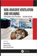 Non-Invasive Ventilation and Weaning (Color)