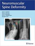Neuromuscular Spine Deformity (Color)