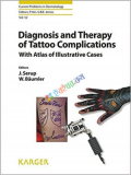 Diagnosis and Therapy of Tattoo Complications (Color)