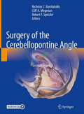 Surgery of the Cerebellopontine Angle (Color)